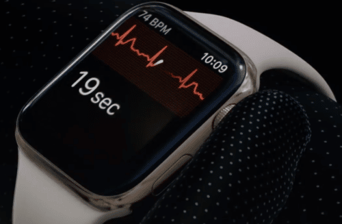 EKG mit der Apple Watch 4 – Marketing oder tatsächlich hilfreich?